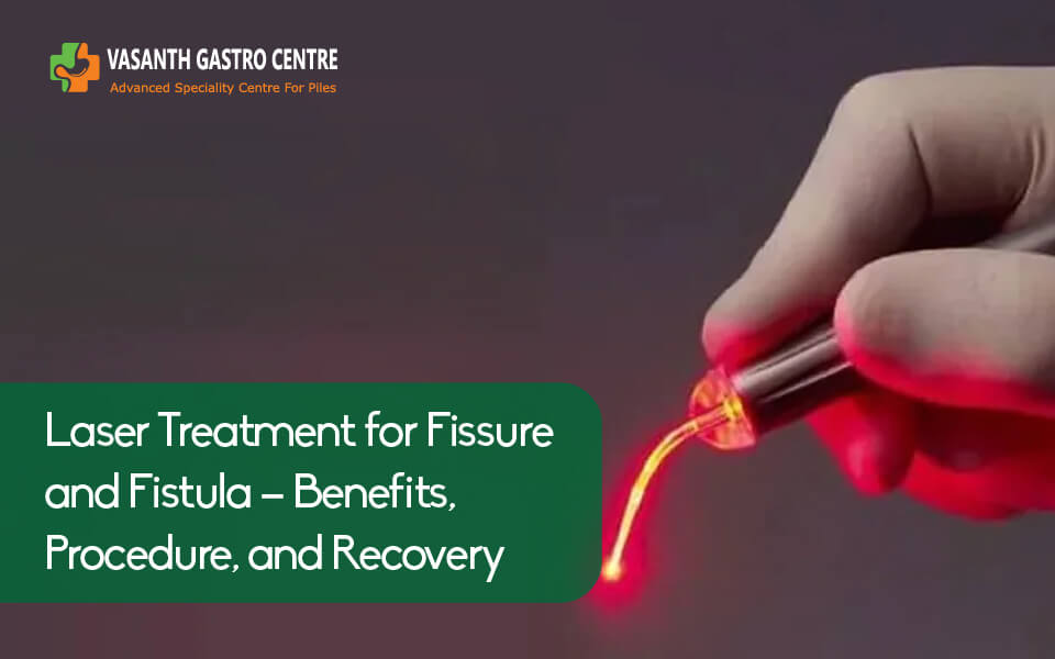 Laser Treatment for Fissure and Fistula - Benefits, Procedure, and Recovery